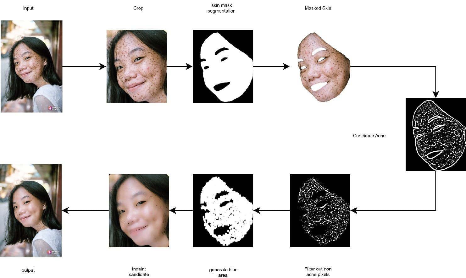 Acne Detection & Removal — processing pipeline